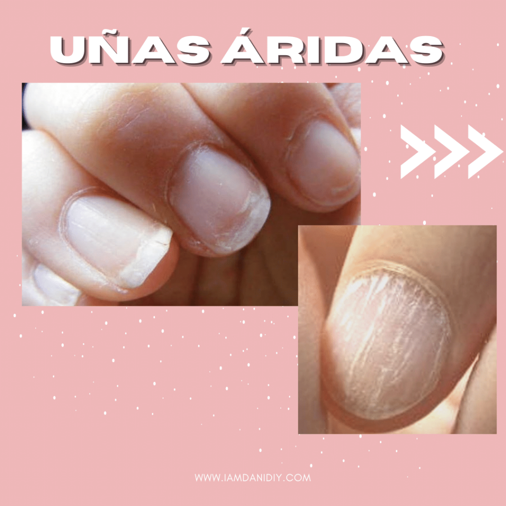 tipos de uñas aridas