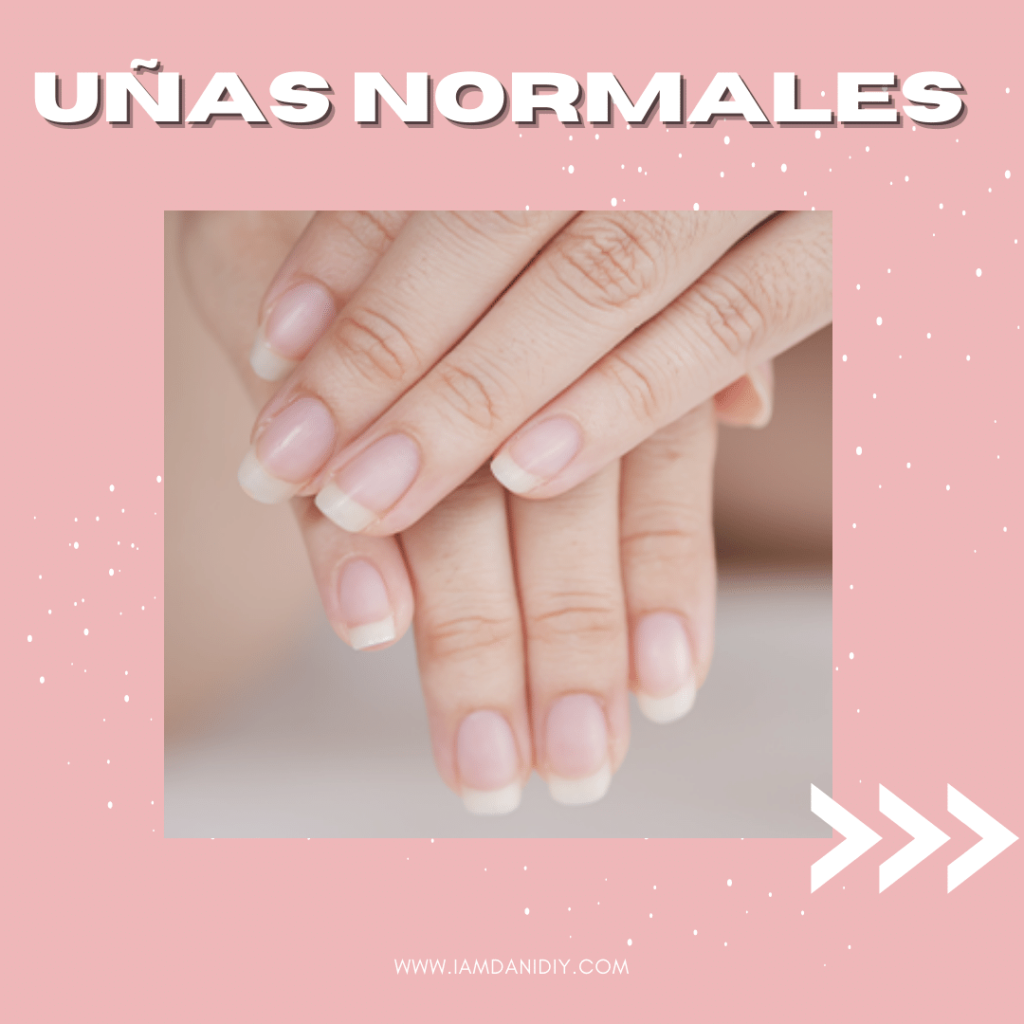 tipos de uñas normales
